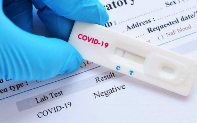 Test de COVID-19 para policías locales y trabajadores del Servicio de Ayuda a Domicilio