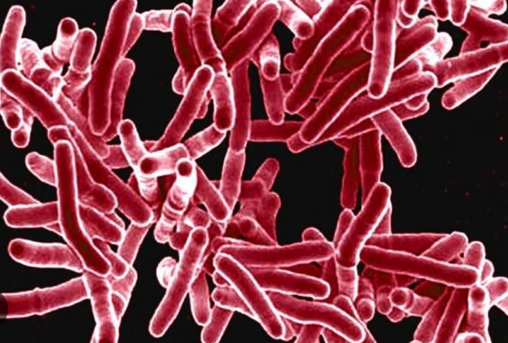 Tuberkulosi-kasu baten detekzioa Bilboko ikastetxe batean